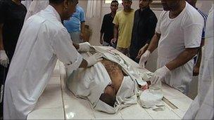 Body of Bahraini who died in police custody
