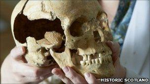 scientist holding skull found at Stirling Castle