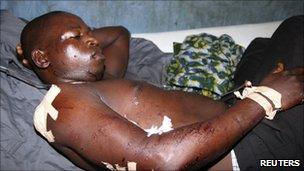 Man injured by bomb blasts in Bauchi (30 May 2011)