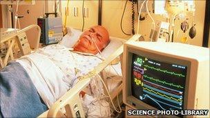 Patient in cardiac intensive care - file photo