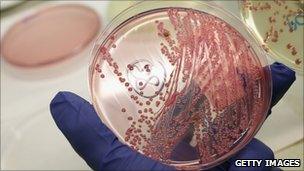 A bacteria culture showing a positive infection of enterohemorrhagic E. coli
