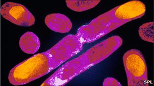 Insulin producing E. coli