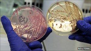 An employee holds petri dishes with bacterial strains of EHEC bacteria at the University Clinic Eppendorf in Hamburg, 2 June 2011.