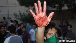 Protester holds up bloodied hand in Tehran rally.