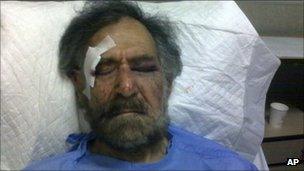 Ali Ferzat in hospital - picture released 25 August 2011