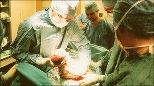 A Caesarean section taking place