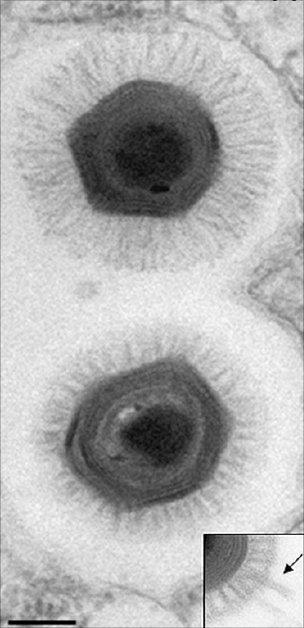 Мимивирус (вверху) и мегавирус (внизу). Масштабная линейка = 200 нанометров