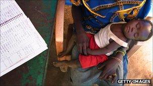Child suffering from malaria in south Sudan