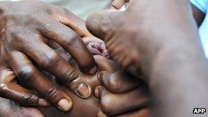 Archive photo of a child receiving an oral polio vaccine in Ivory Coast