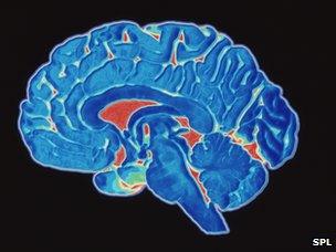 Scan of a human brain