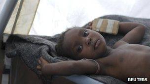 A child undergoing treatment for cholera in Haiti's capital Port-au-Prince, 27 November 2011.