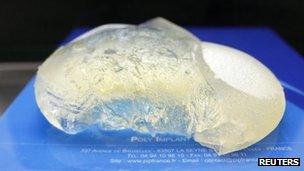 A defective silicone gel breast implant, which was removed from a patient and manufactured by French company Poly Implant Prothese