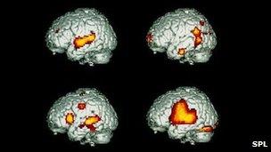 Scans showing brain activity when speaking/listening