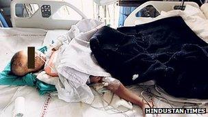 Toddler in Delhi hospital. Pic: Hindustan Times.
