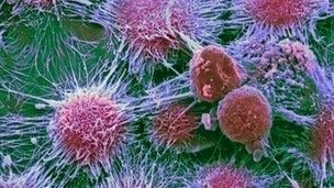 Kidney Cancer cells