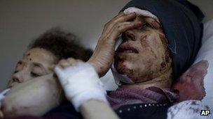 Injured Syrians in Idlib, Syria. Photo: March 2012