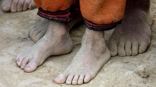 Feet of Tajik children after a long day of harvesting