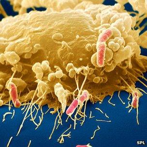 Macrophage engulfing E coli bacteria