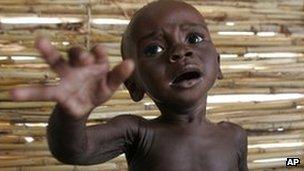 A malnourished boy in Niger. File photo