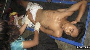 Injured people are treated in Sittwe General Hospital in Rakhine June 3 2012.