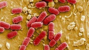bacteria E. coli