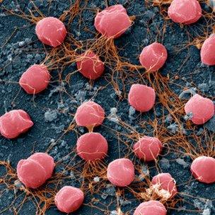 Pyrococcus furiosus archaea
