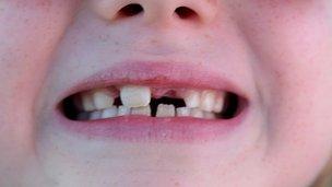 The gap-toothed smile of a 7-year-old child