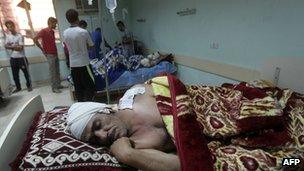 A wounded Iraqi man lies on a hospital bed following a blast in Baghdad's mainly Shia Sadr City district, on 10 September