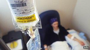 Woman having chemotherapy