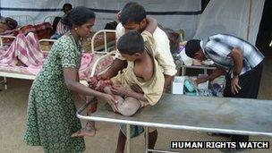 An injured child in the Vanni region of Sri Lanka