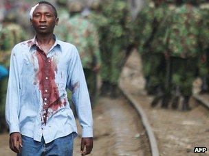 Injured man in Kibera slum, Nairobi, in January 2008