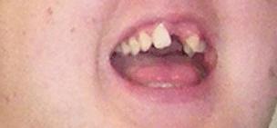 Ben Pullar's teeth