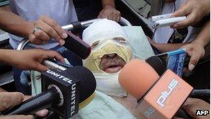 Fernando Vidal speaks to the press after being treated in hospital