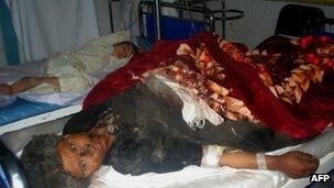 A survivor of the blast recovers in hospital in Farah province