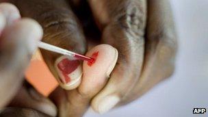 A person does a blood test at a roadside Aids testing table in Langa, a suburb of Cape Town in December 2010
