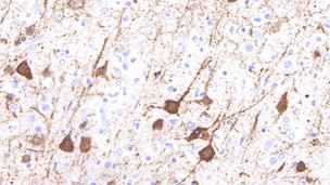 Neurons infected with SBV