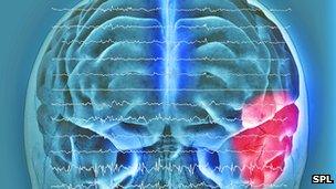 Brain