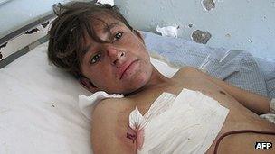 A wounded Afghan boy receives treatment at a hospital in Kunar province following a Nato air strike (13 February 2013)