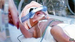 Baby in neonatal intensive care