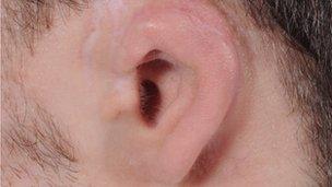 Brian Hogg's ear