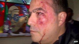 Picture released Julio Borges' Primero Justicia party showing him after clashes in parliament