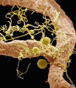 Microscope image of mycorrhizae