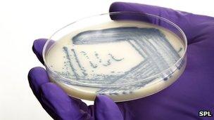 Bacteria in Petri dish