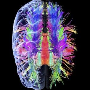 Brain