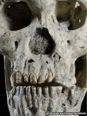 The face of Dmanisi Skull 5