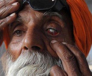 Man with cataract