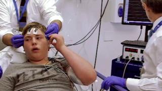 Jonah having ECT