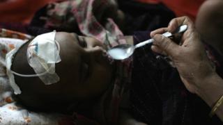 বাংলাদেশে আইসিডিডিআরবি-তে চিকিৎসারত এক শিশু