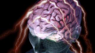 brain scan - conceptual image
