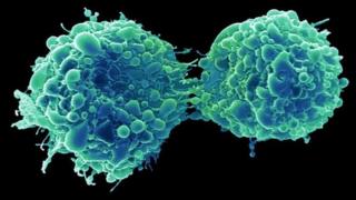 Un virus du rhume a infecté et tué des cellules cancéreuses de la vessie dans l'étude.